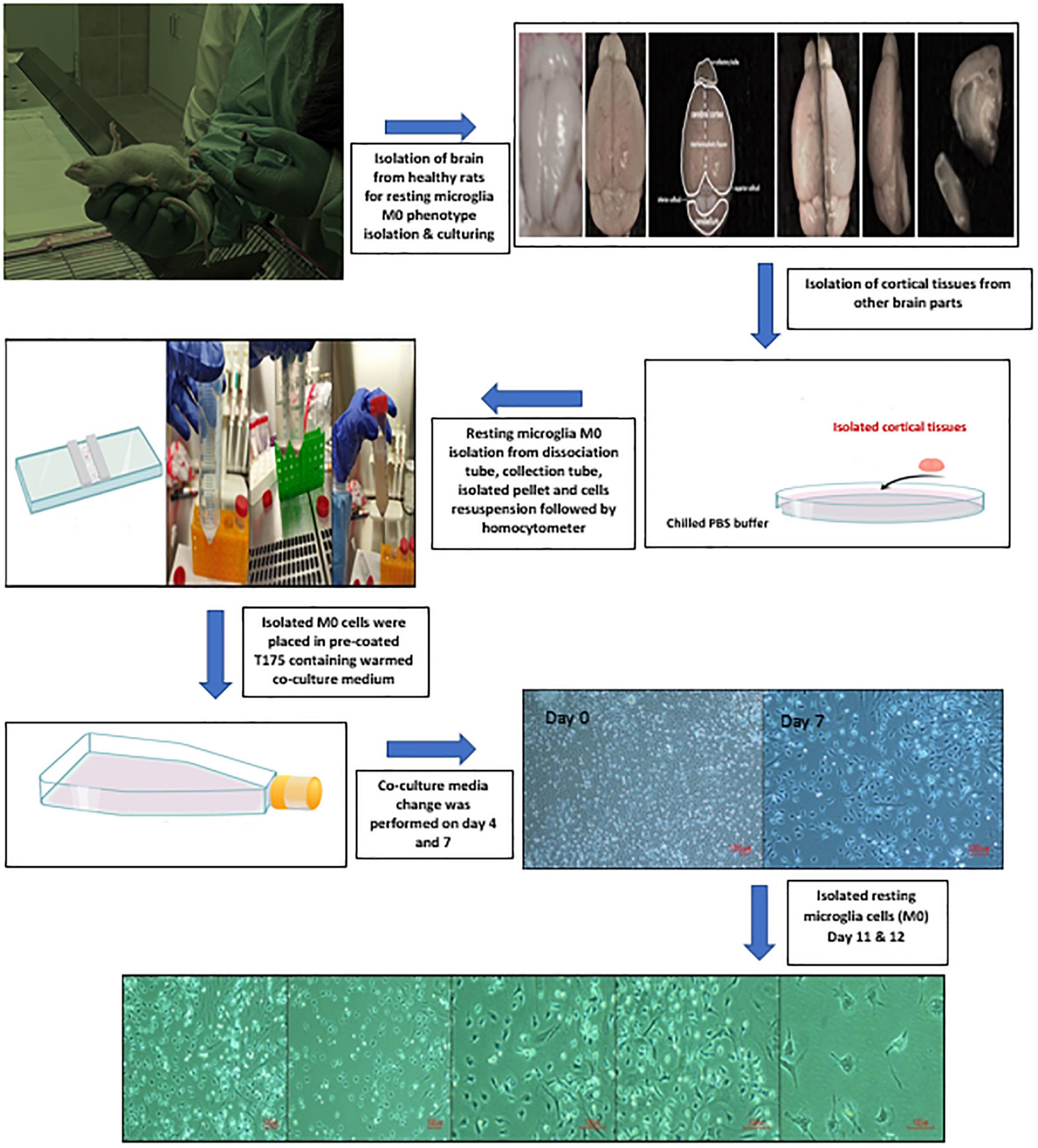 Assessing the role of primary healthy microglia and gap junction blocker in hindering Alzheimer’s disease neuroinflammatory type: Early approaches for therapeutic intervention